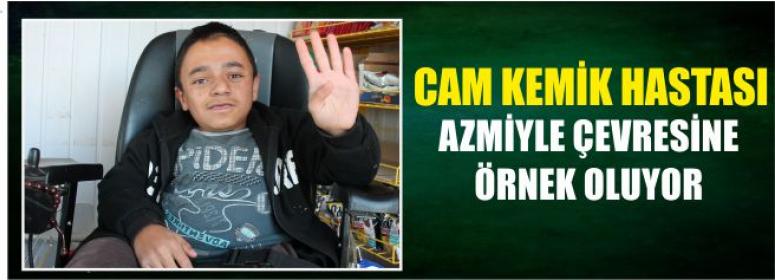 Cam Kemik Hastası Azmiyle Çevresine Örnek Oluyor